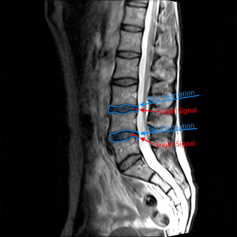 Educational MRI illustrations – CareFirst